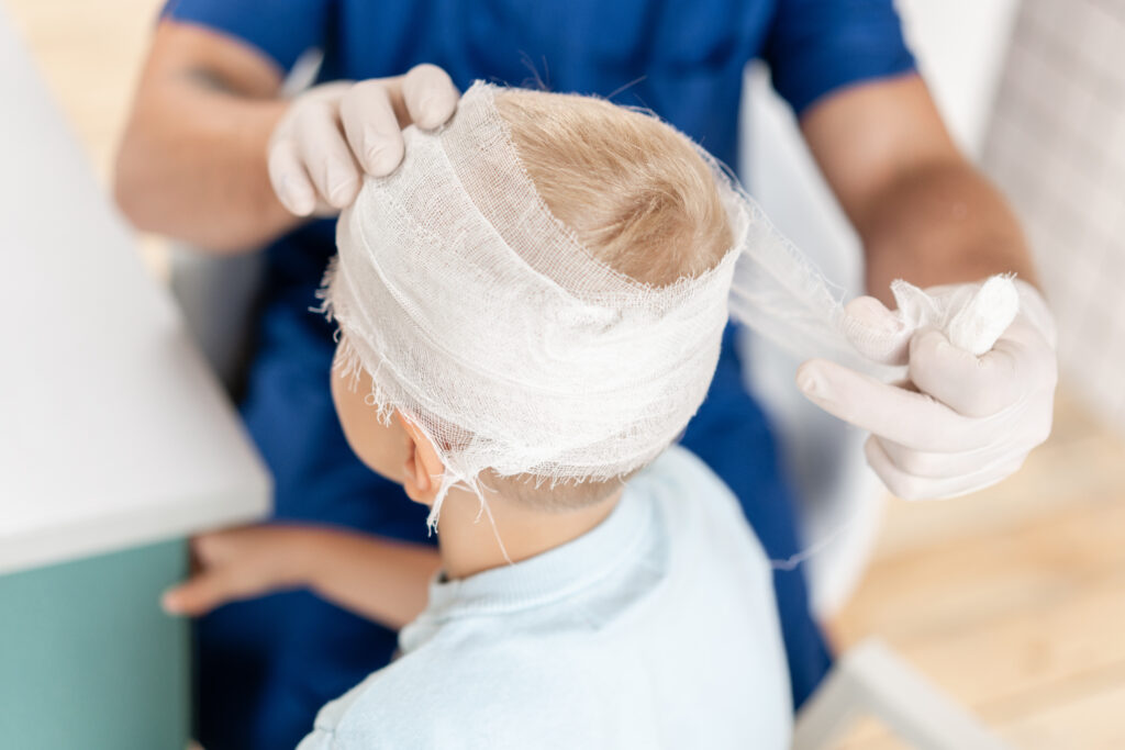 Explore common incidents like car accidents and falls that often lead to traumatic brain injuries